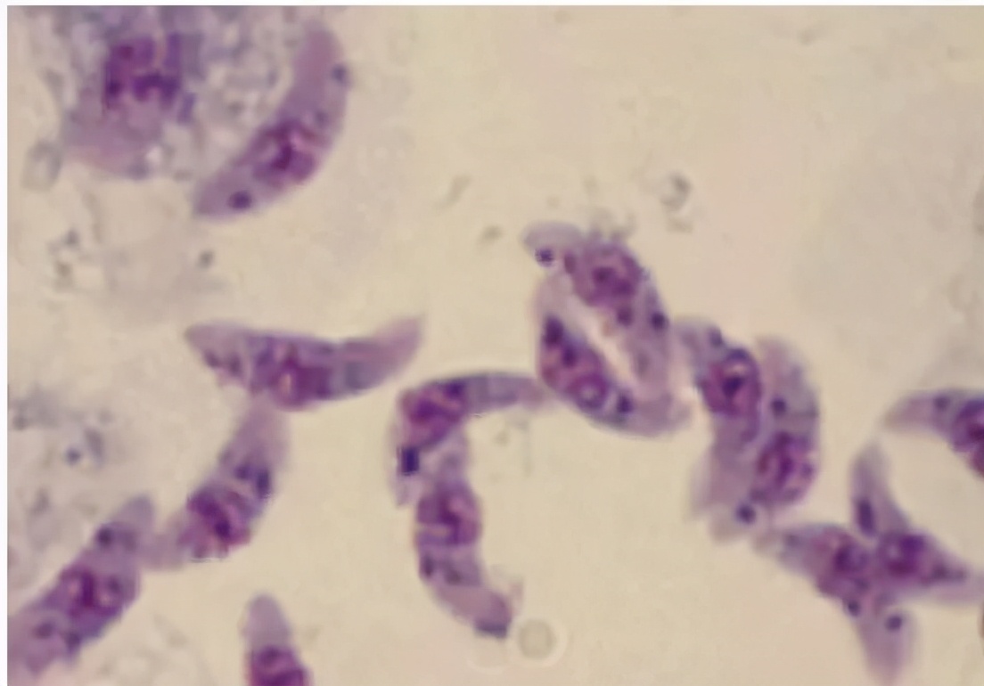 人宠共患病,弓形虫病是人畜共患病吗