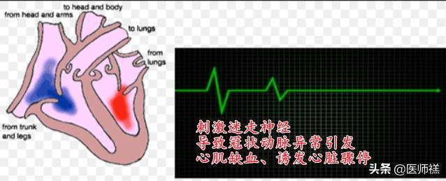 肝囊肿穿刺和微创切除哪个风险大,肝脏穿刺风险和后遗症
