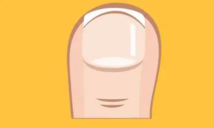 小知识一不小心扭伤脚了怎么处理,小脚趾指甲冷知识