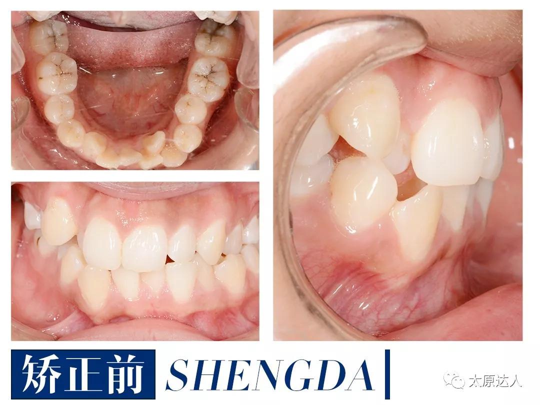 山西“爱马仕”级别齿科医院！get明星同款笑容