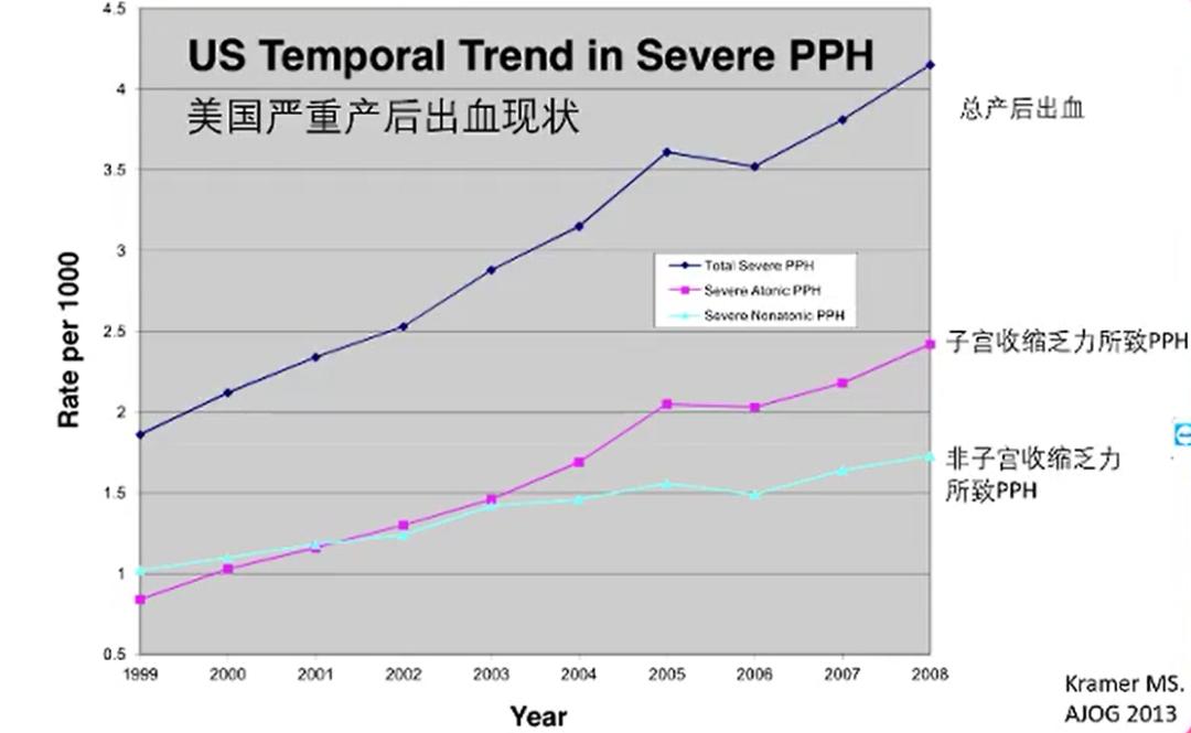 产后出血最新指南ppt,产后出血200毫升多吗