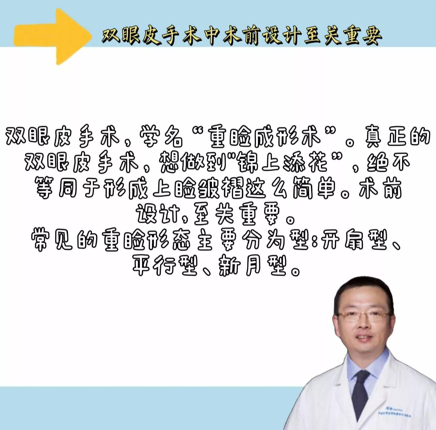 双眼皮类型有哪些及其图片,双眼皮常见的几种类型
