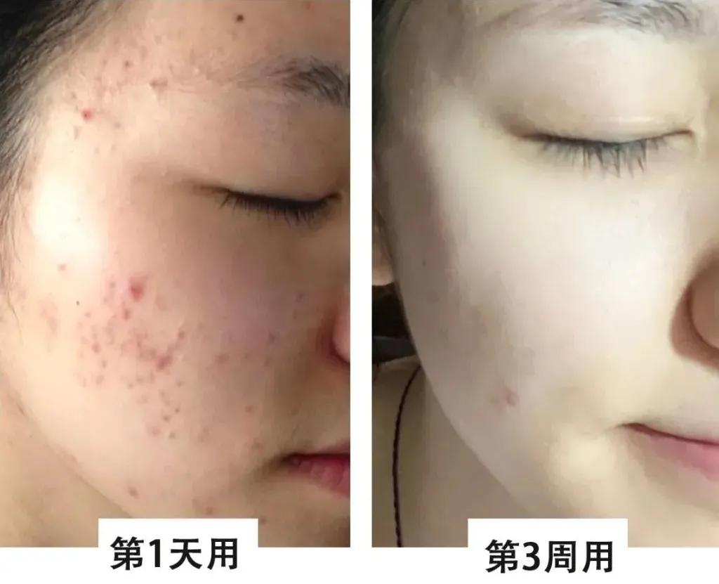 快用完的洗面奶,真正有效的清洁毛孔的洗面奶