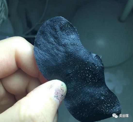 牙膏真的可以去粉刺吗,牙膏对鼻子黑头有什么作用