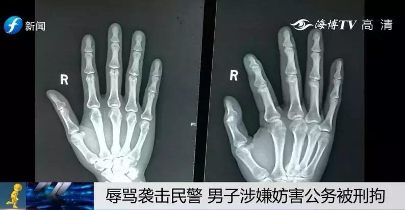 男子殴打女友被警方逮捕,男子将女友殴打致死被公诉