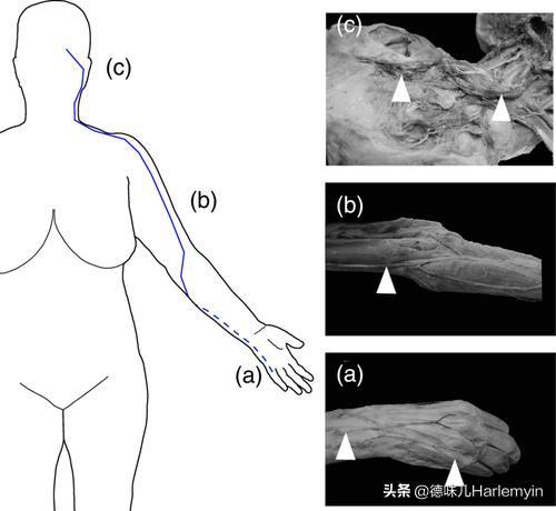 马王堆竹简内容完整版,马王堆解剖过程