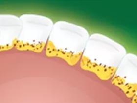 孩子不爱刷牙用漱口水可以吗,你家宝宝刷牙也喝漱口水吗