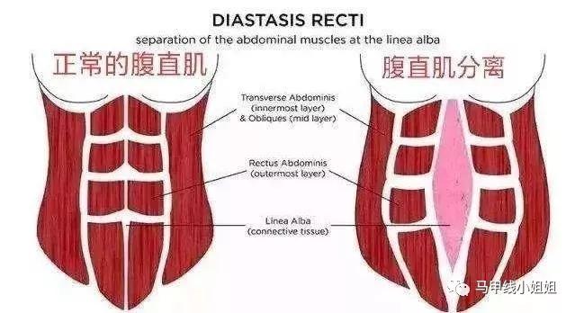 瘦腰塑形腰带是不是智商税,网红束腰带真的有用吗