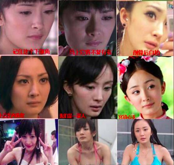 杨幂这些整容后遗症告诉你，不断返厂重修，代价得不偿失