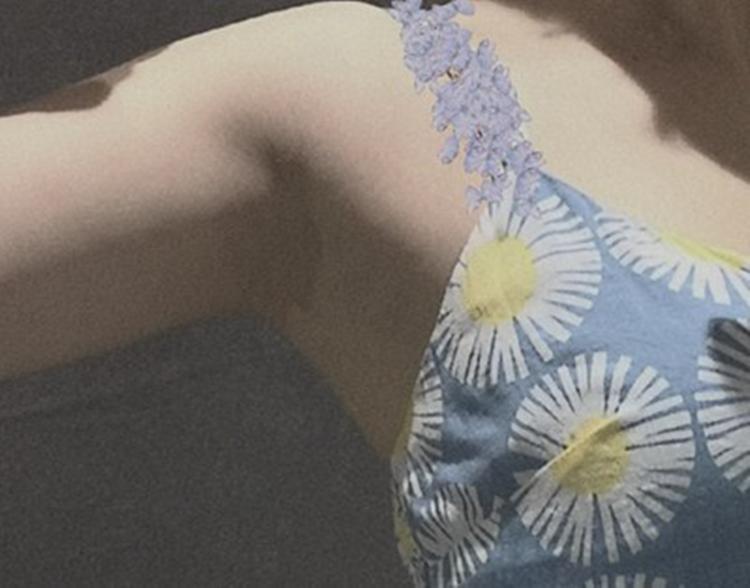 夏天冰点无痛脱毛好处,夏日无痛脱毛