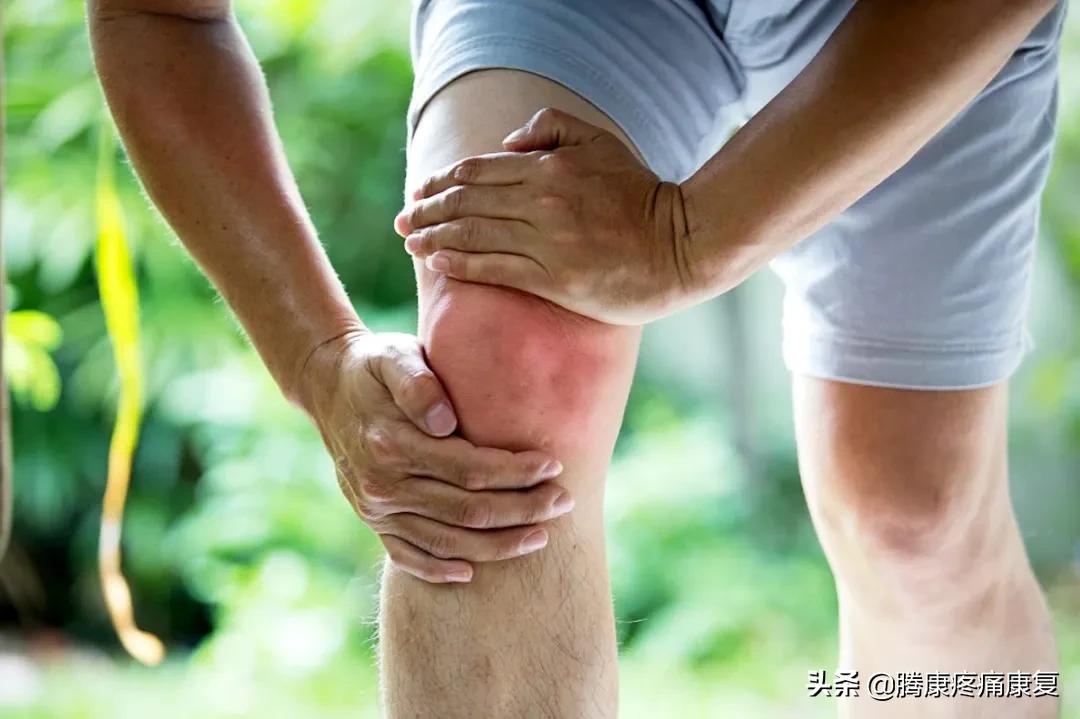 理疗对骨性关节炎有什么作用,骨性关节炎炎症怎么消除