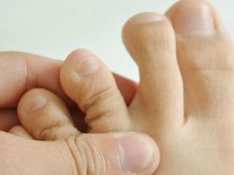 甲沟炎拔完很痛,学会小妙招或能告别甲沟炎