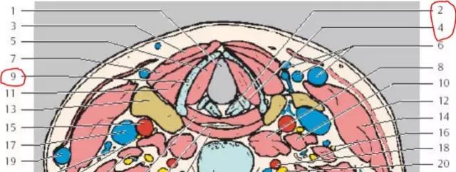 喉部病变做核磁还是ct,耳鼻喉科常见病影像诊断