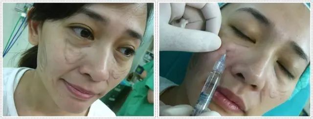 导致衰老的是哪个器官,导致衰老的原因