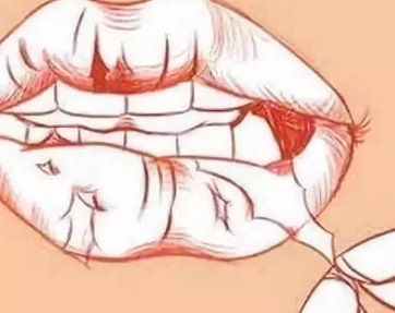 舔嘴唇会让嘴巴湿润吗,舔嘴唇嘴唇干裂怎么办