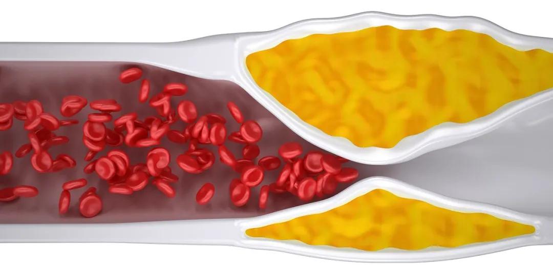 降胆固醇和降血脂最快的十种食物,八种食物降血脂降血压