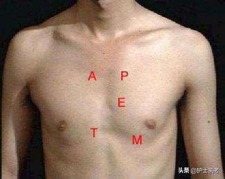 执业医师技能考试心脏瓣膜病真题,风湿性心瓣膜病护考习题