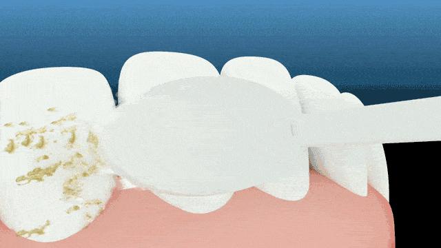 成人肠胃不好口臭除根的最好办法,成人口臭是怎么回事怎么治疗