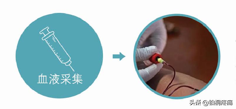 老年人膝盖变形疼痛怎么办,老年人膝关节痛严重变形怎么治疗