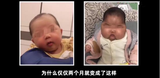 婴儿用激素抑菌霜变成了大头娃娃,婴儿抑菌霜被曝
