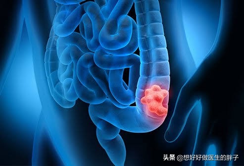 左侧腹部隐痛检查不出原因,肚脐眼左侧腹部隐痛做哪些检查