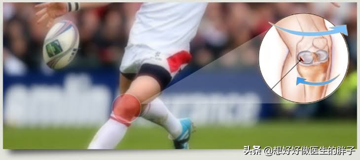 足球运动员为什么没有半月板,足球到底伤半月板吗