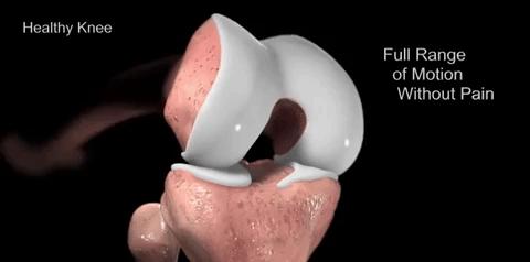 髌骨软化上下楼膝盖不痛正常吗,膝盖疼说是髌骨软化怎么办