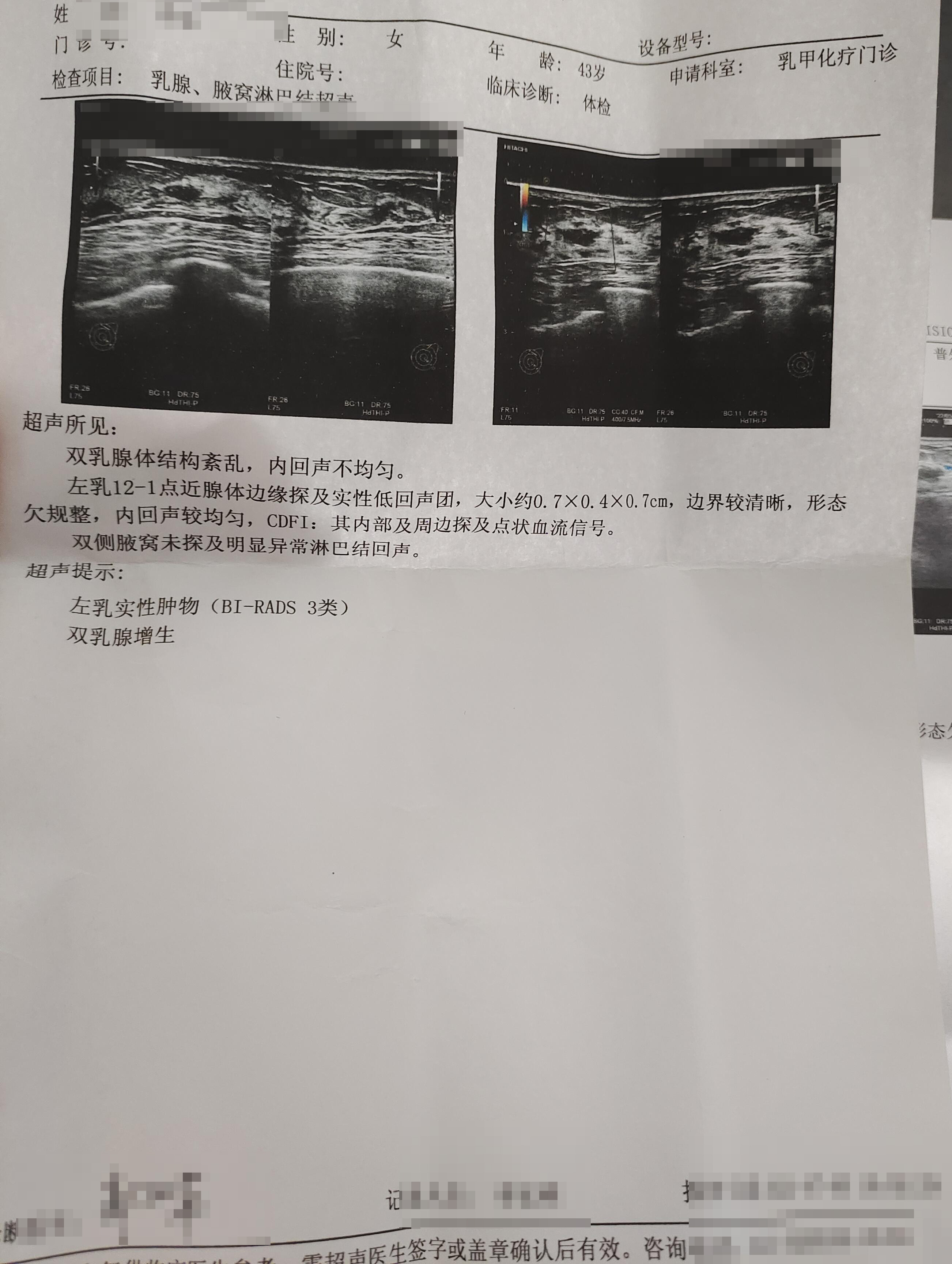 乳腺增生,经前加重,月经量少,多因气滞血瘀!一张方子,巧化解