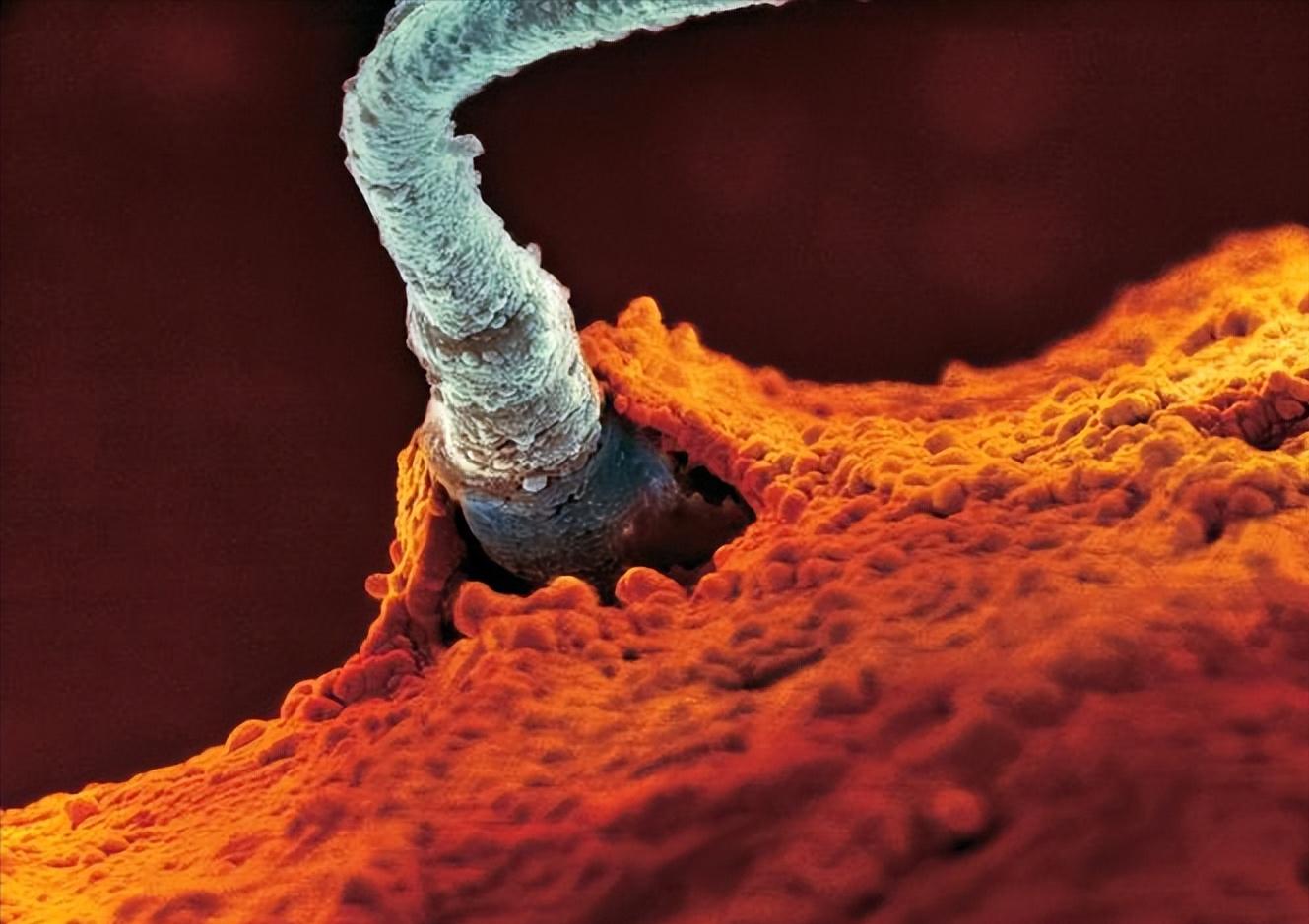 跑得最快的精子，才能和卵子结合？没成功“受精”的精子都去哪了