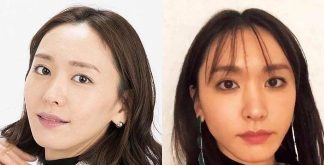 年纪大了为什么头发稀疏了,随着年龄增长头发变稀疏正常吗