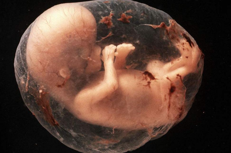 阴阳人是否确实存在,阴阳人既有精子也有卵子吗