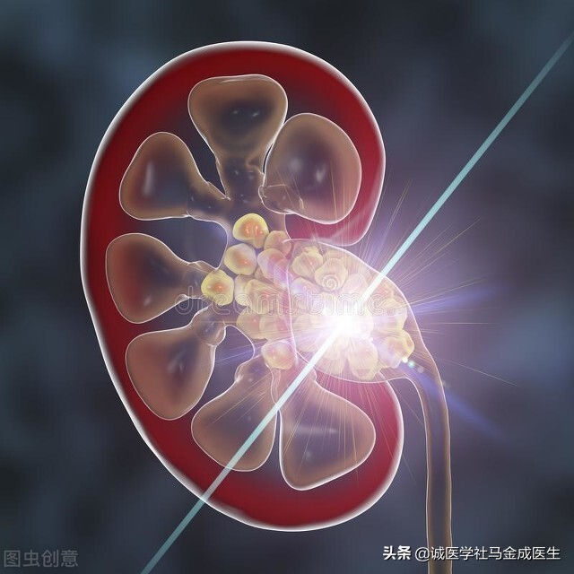 有助于消结石的中药,结石吃什么草药比较容易排出来