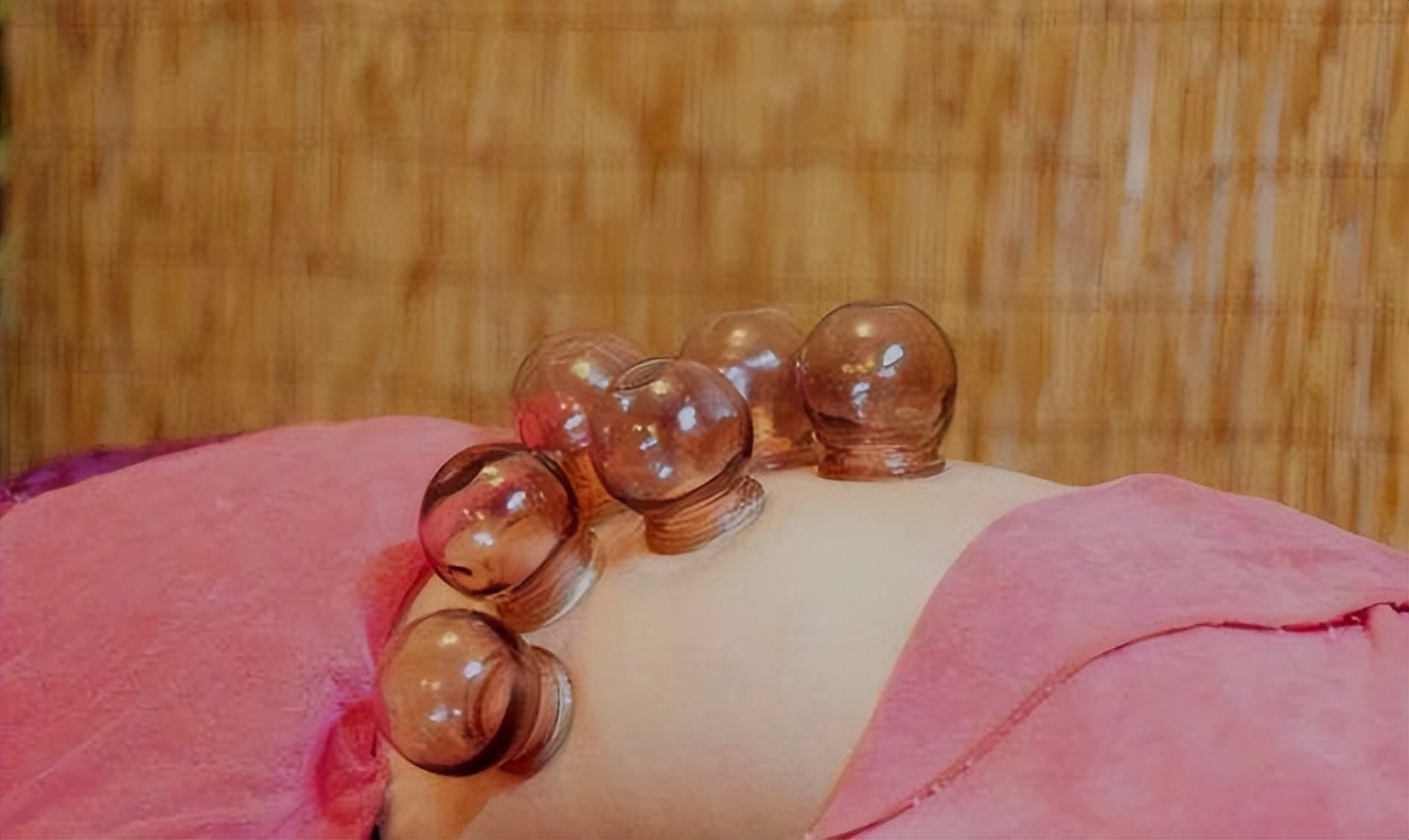 拔火罐吸出来的是湿气还是毒素,拔火罐吸出来的淤血是什么