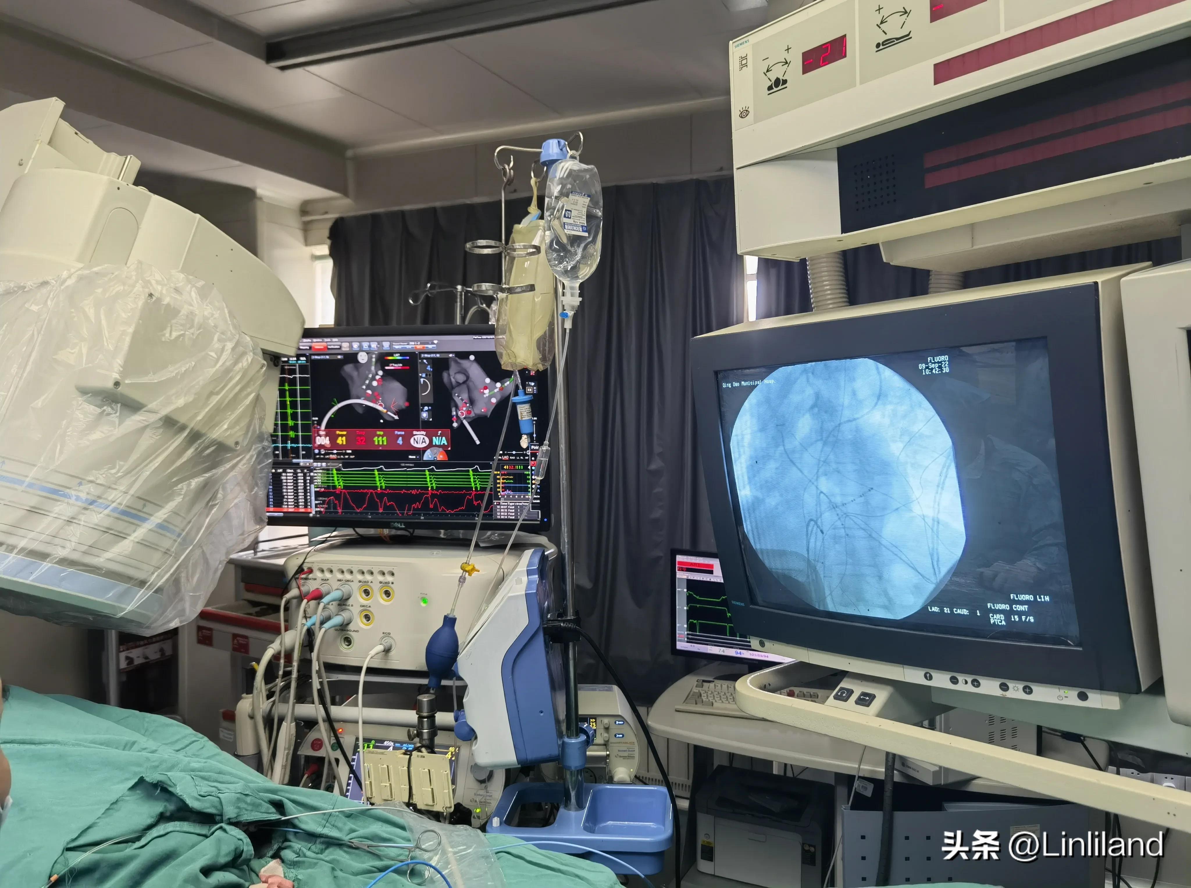 过速性房颤治疗,持续性房颤心动过速