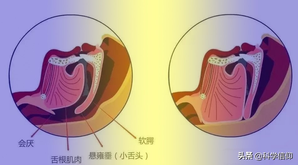 打鼾呼吸困难原因,打鼾呼吸不畅缺氧发炎
