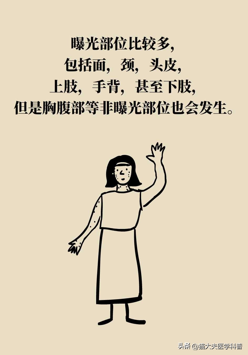 脖子上长的小肉揪怎么治啊,疣丝是不是脖子上的小肉粒