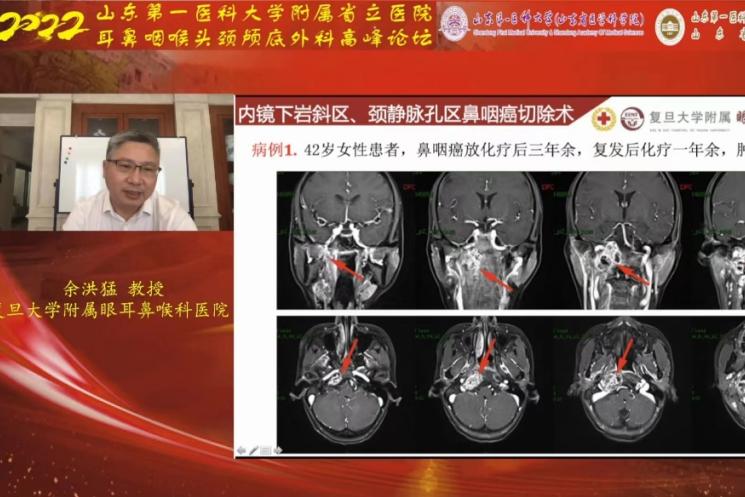 全国耳鼻咽喉头颈外科学术会议,微创高峰论坛举行