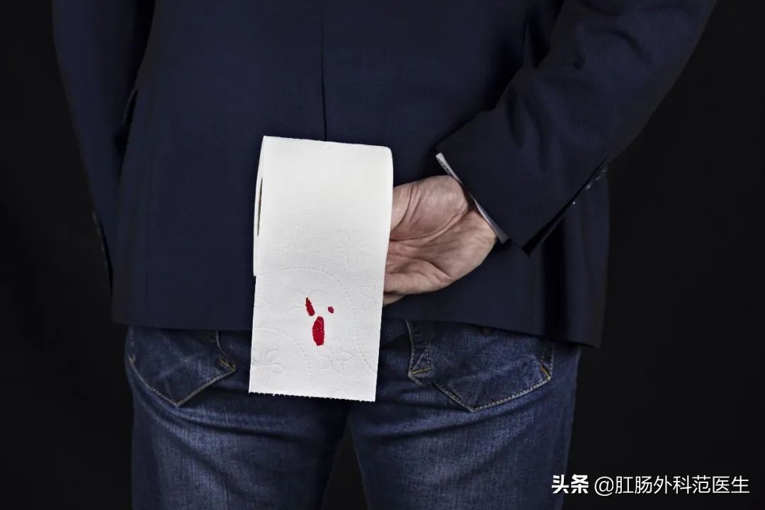 内痔出血如何用药物治疗,内痔为什么会出血