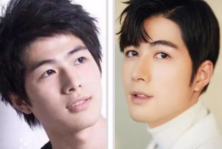 割了双眼皮颜值大增的明星,论娱乐圈割双眼皮最失败的明星