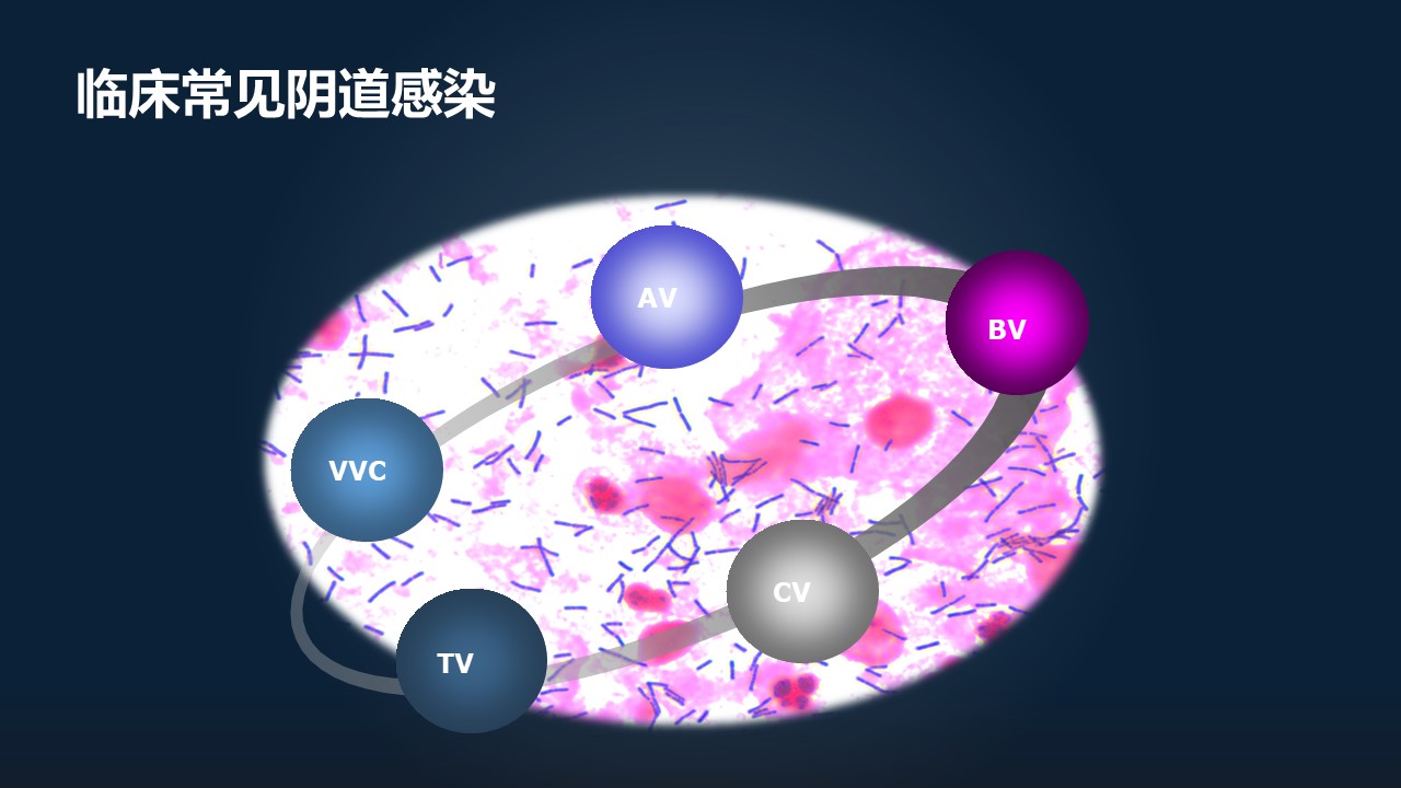 未婚女性常见的妇科病有哪些,已婚妇女一般会得妇科病吗