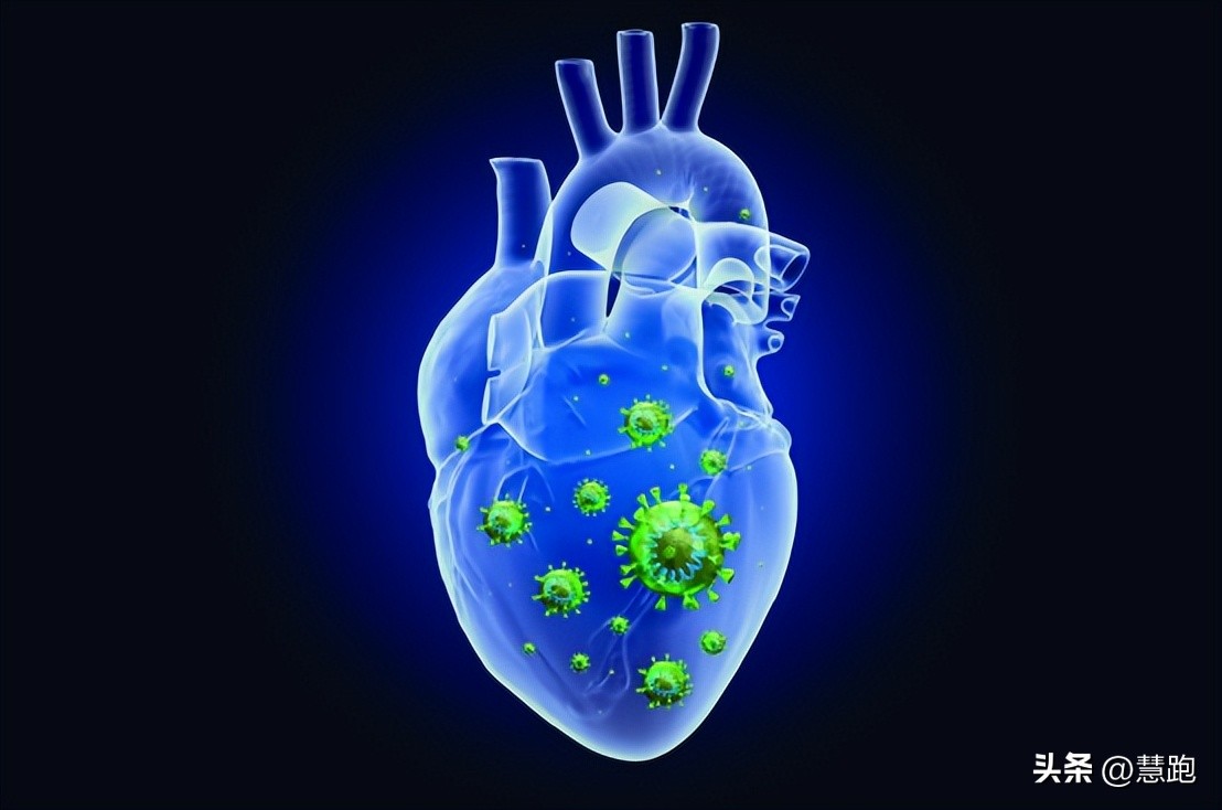 阳康后哪些运动算剧烈运动,阳康剧烈运动心肌炎能治好吗