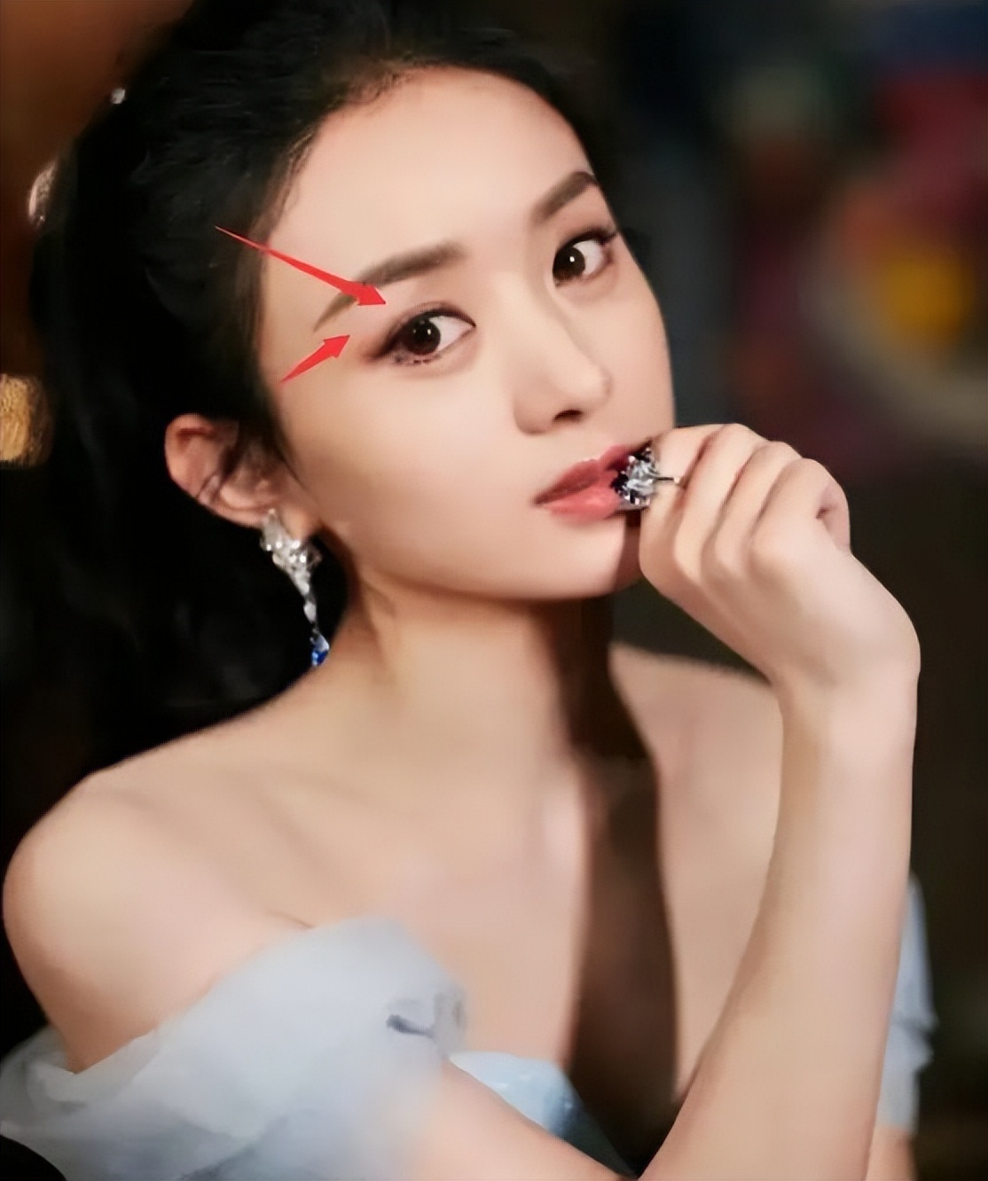 做双眼皮真相,做双眼皮要了解的问题