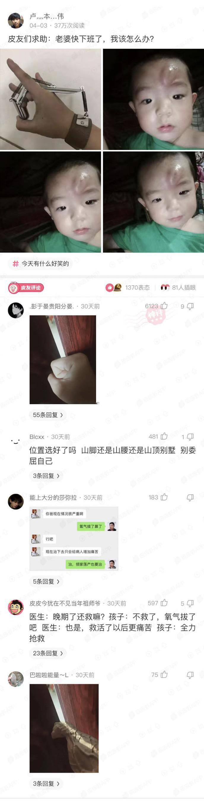 神回复：把儿子头弹破了，老婆马上回家怎么办？我只想留条命
