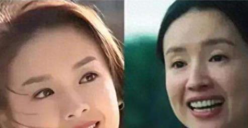 明星烤瓷牙发黑,明星烤瓷牙牙齿磨小后照片