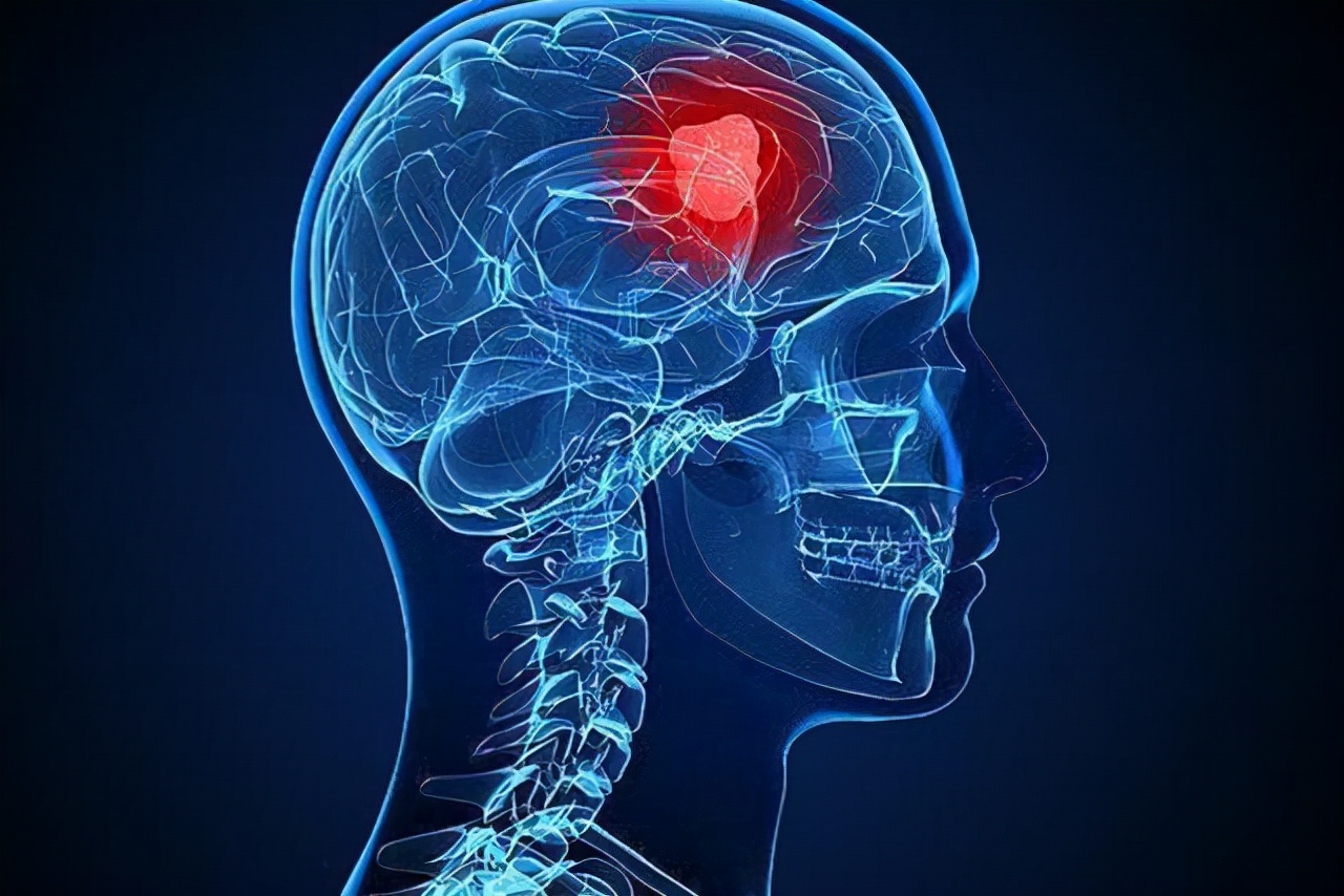 左眼皮上眼皮跳是什么预兆呢,左眼皮上眼皮跳是好运还是厄运