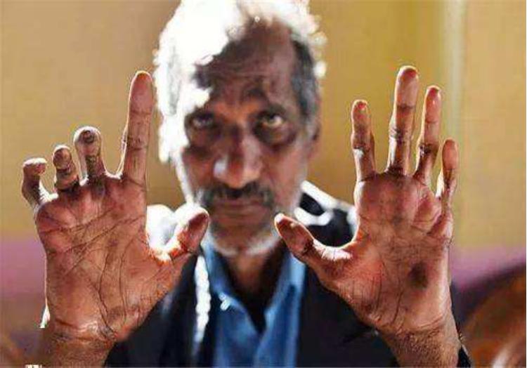 犰狳刀枪不入,美洲犰狳