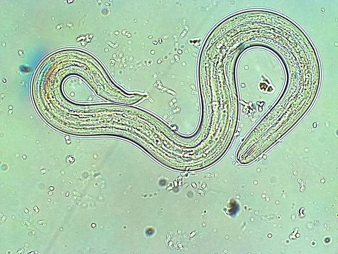 泳池的水有多脏,游泳怎么样可以防止下体进水感染