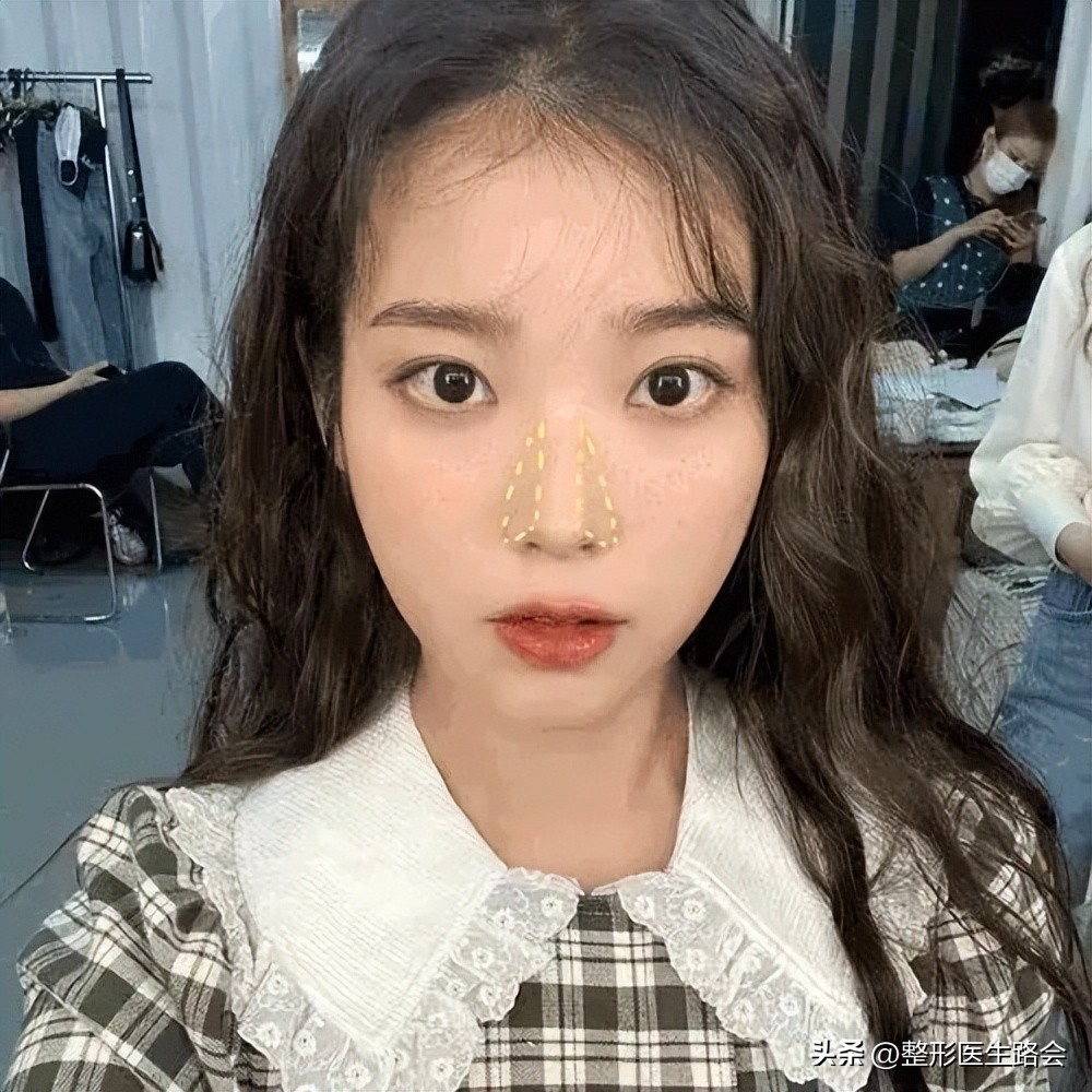 塌鼻子做什么样的鼻子安全,塌鼻子应该选择哪种隆鼻