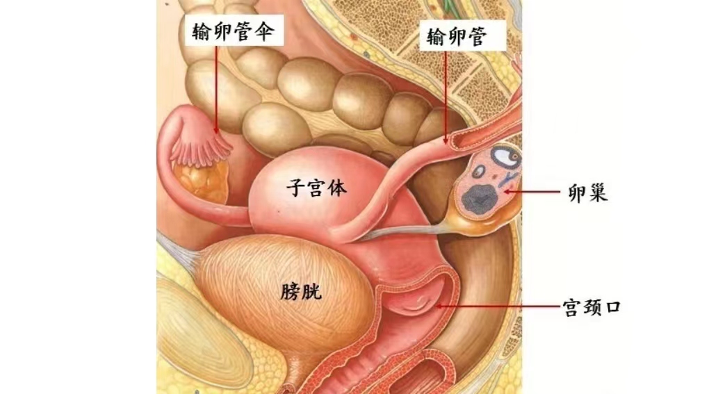 58岁女子小腹疼痛，按盆腔炎治疗半年无效，换家医院才发现误诊了