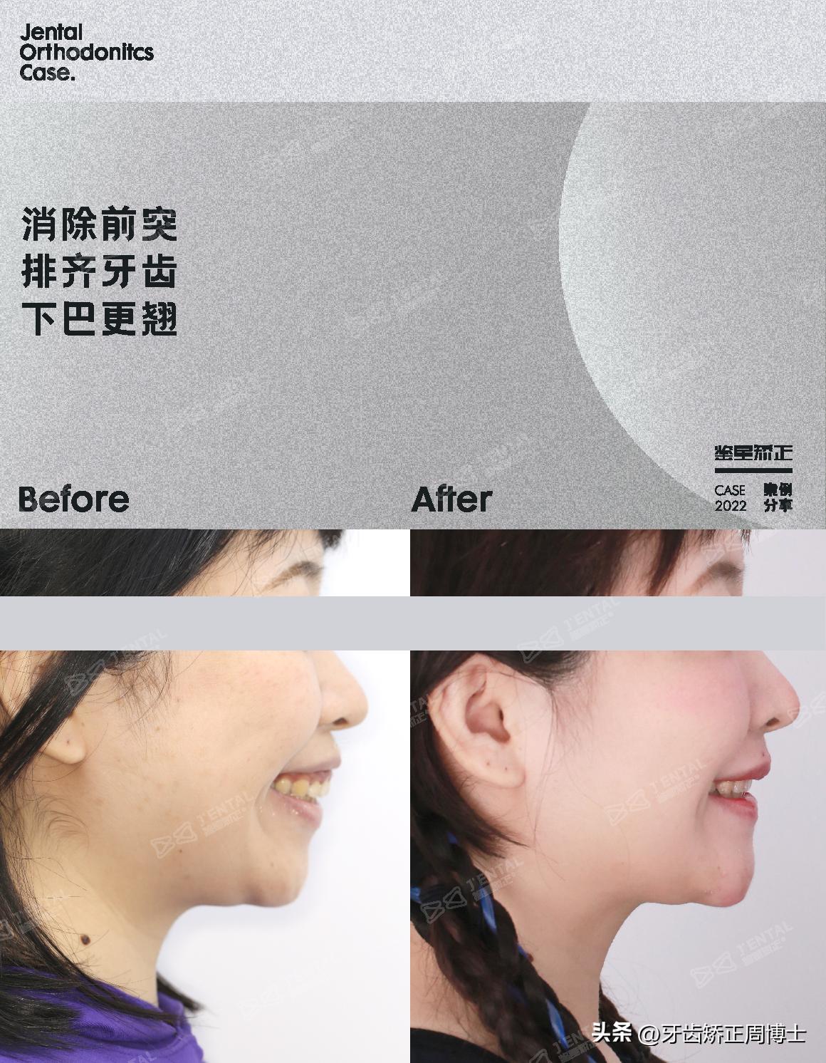 <html>
<head><title>502BadGateway</title></head>
<body>
<center><h1>502BadGateway</h1></center>
<hr><center>nginx</center>
</body>
</html>
<!--apaddingtodisableMSIEandChromefriendlyerrorpage-->
<!--apaddingtodisableMSIEandChromefriendlyerrorpage-->
<!--apaddingtodisableMSIEandChromefriendlyerrorpage-->
<!--apaddingtodisableMSIEandChromefriendlyerrorpage-->
<!--apaddingtodisableMSIEandChromefriendlyerrorpage-->
<!--apaddingtodisableMSIEandChromefriendlyerrorpage-->
